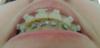 dsc09143.jpg