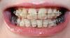 06.03.13_nch_2.jpg