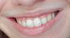 smile.jpg