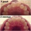 kollazh_2_mesyaca_10_dney_vid_snizu.jpg