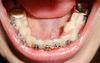 низ_20131005.jpg низ_20131005.jpg