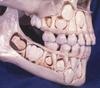 Детский череп перед потерей молочных зубов.