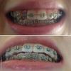 c_cdd837a0b38c2a7e207835938d9a5c13.jpg вот такое у меня смыкание