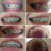 c_0d7cf82beacd7db7f5bc6cdc1bf8be68.jpg изменения за 7 месяцев