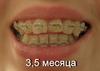 sdc14764.jpg