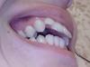 img_20131113_092722-1.jpg