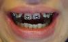 p_20160830_211731_bf_1.jpg
