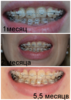 результат 5.5 мес.