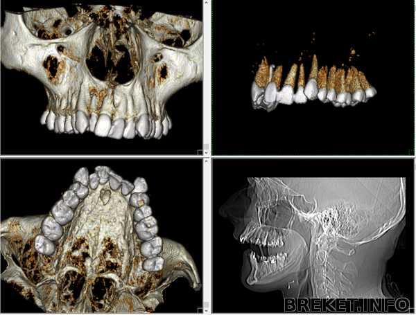 Томограмма №1