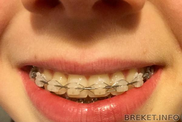 Скоро снимать 