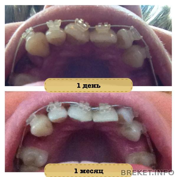 Первый месяц-коллаж.jpg