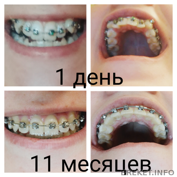 11 месяцев