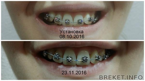 15_mesyaca.jpg