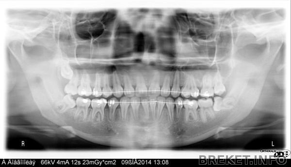 optg_09.01.2014.jpg