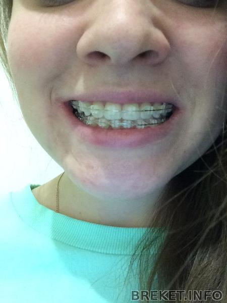 перед снятием