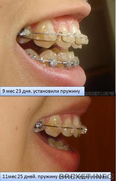 naklon.jpg