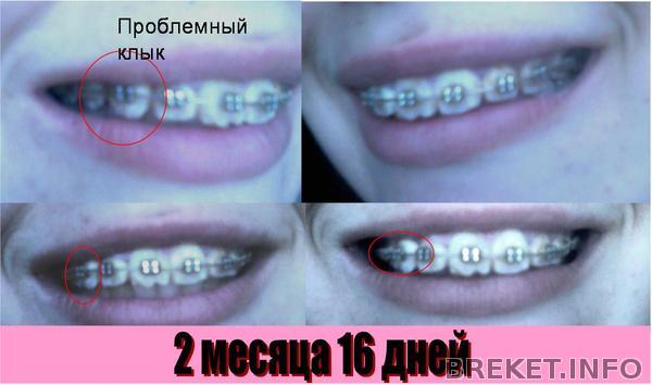 2 мес ВЧ