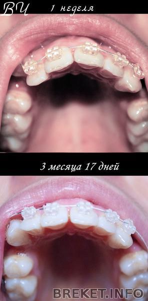 sravnenie_vch_ot_nachala_do_317.jpg