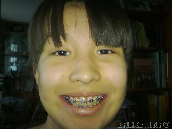rrdzsrdz5331.jpg