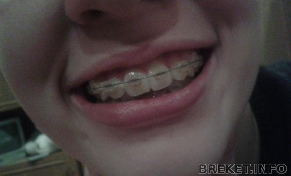 2013-02-09_21.13.15.jpg