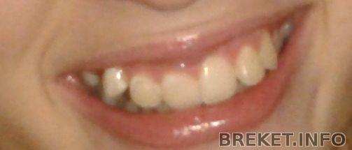 2012-08-29_22.36.18.jpg