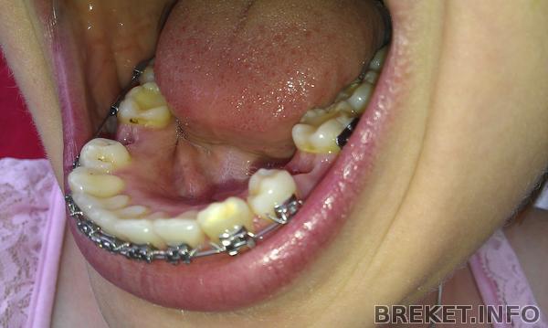 1g9m25_-_1g5m11_15.jpg 1g9m25_-_1g5m11_15.jpg