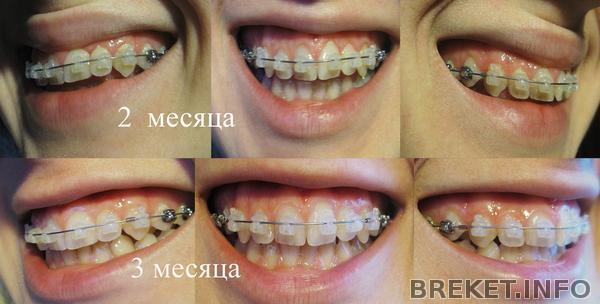 2-3 месяц