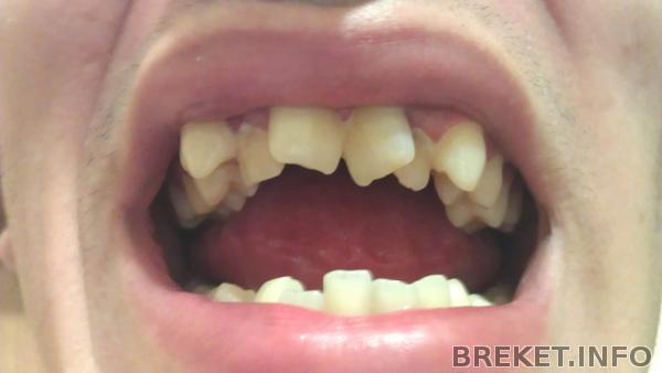 Перед установкой