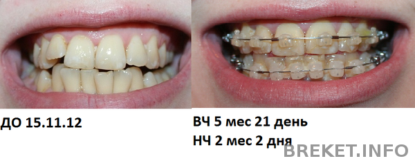 srav_obshchee_5m21d_2m2d.png