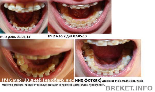 srav._nch_6_mes_13_dney.png