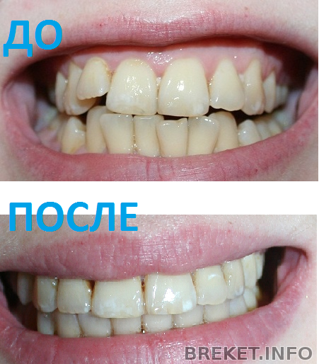 do_i_posle.png do_i_posle.png