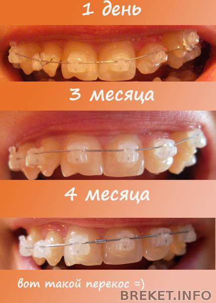 4_mes.jpg 4 месяца