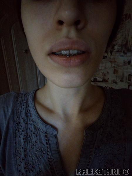 10,5 мес