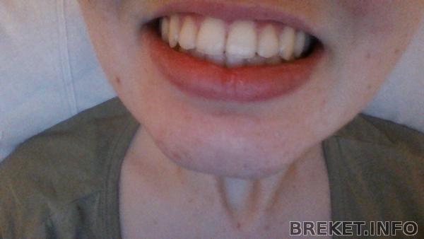 win_20150325_195809.jpg win_20150325_195809.jpg