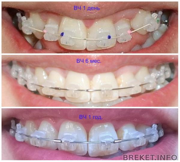 collage_013.jpg collage_013.jpg