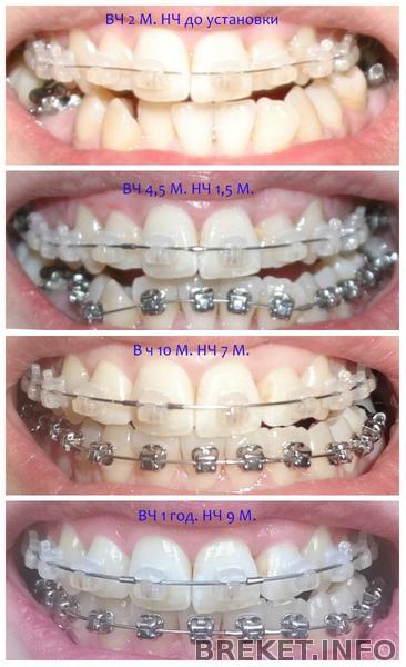 collage_011.jpg collage_011.jpg