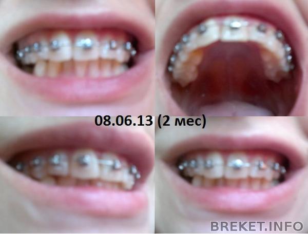 08.06.13 (2 мес)