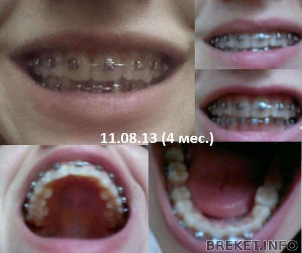 11.08.13 (4 мес)