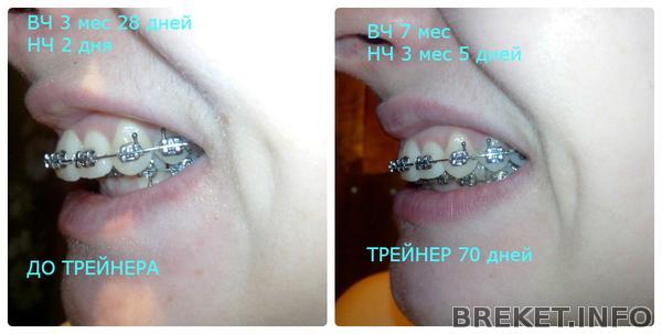 3.28_-_7_mes_treyner_70_dney.jpg 3.28_-_7_mes_treyner_70_dney.jpg