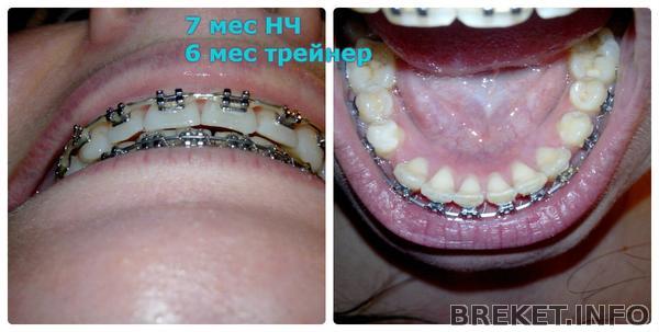 7_mes_nch.jpg 7_mes_nch.jpg