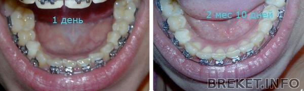 1 дн и 2 мес.jpg 1 дн и 2 мес.jpg