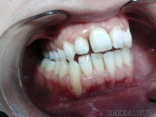 2012-07-17_11.35.29.jpg