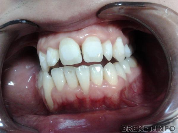 2012-07-17_11.35.51.jpg