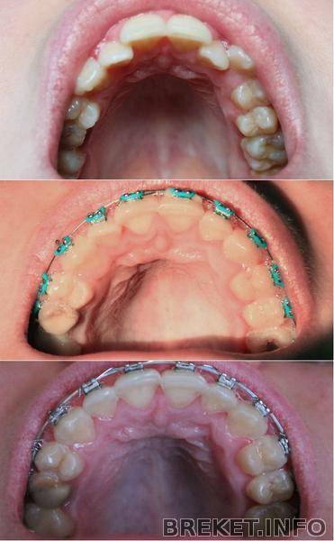1 год 1 месяц
