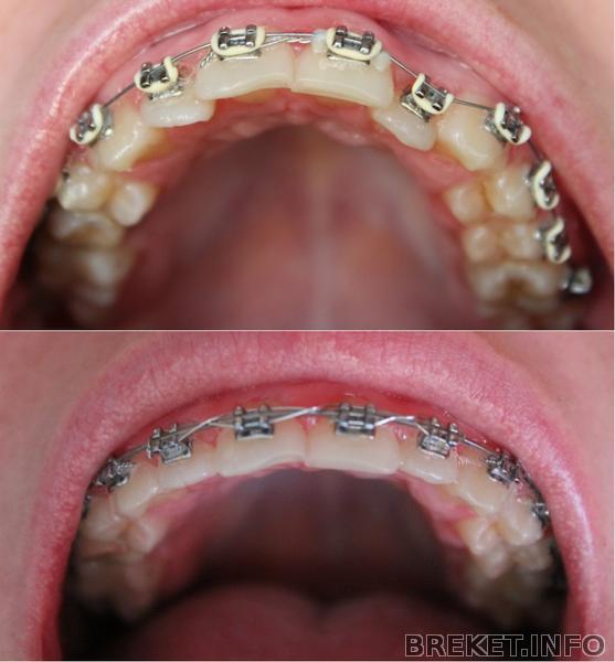 1 год 1 месяц