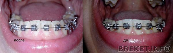 img_20131024_184049.jpg