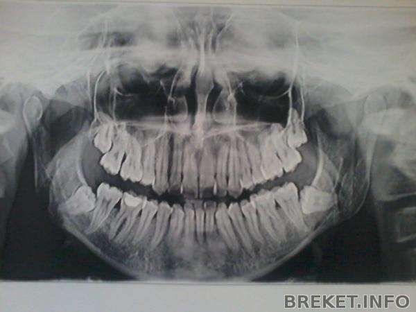 2013-07-15_10.58.47.jpg
