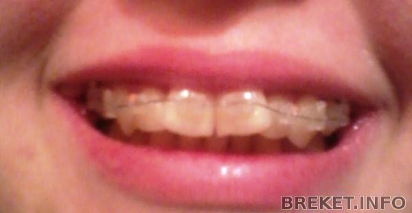 2013-07-23_21.14.43.jpg