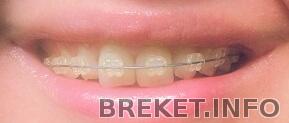 img_20131004_021323.jpg