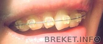 img_20131004_021520.jpg